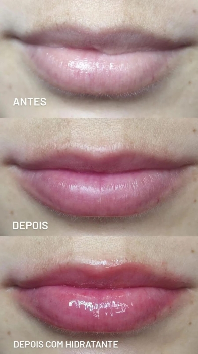 Lip treatments